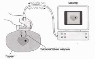 УЗИ мочевого пузыря. Что такое УЗИ, показания, какие болезни выявляет и как проходит процедура
