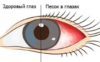 Как бороться с песком в глазах по утрам: советы и рекомендации
