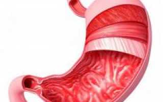 Отрыжка. Отрыжка воздухом, после еды, кислым, с тухлым запахом. Причины отрыжки. Диагностика причин отрыжки. Что делать в домашних условиях и как лечить причины отрыжки? Полезные советы и рекомендации.