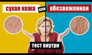 Причины сухой кожи. Что нужно знать, чтобы сохранить кожу здоровой и ухоженной?