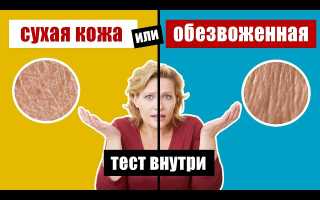 Причины сухой кожи. Что нужно знать, чтобы сохранить кожу здоровой и ухоженной?
