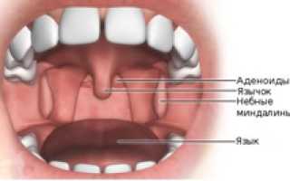 Ангина — причины, симптомы, диагностика и эффективное лечение болезни у взрослых