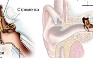 Средний отит — причины, симптомы, современная диагностика и эффективное лечение для здоровья ушей