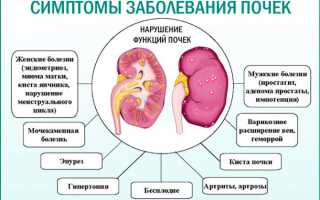 Симптомы проблем с почками у мужчин