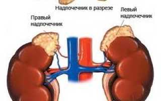 Болезнь Аддисона (недостаточность коры надпочечников) — причины, симптомы, современная диагностика и эффективное лечение для пациентов