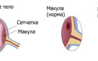 Как действовать при разрыве сетчатки глаза: советы и рекомендации
