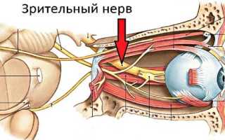 Как и чем вылечить атрофию зрительного нерва эффективно и безопасно