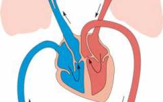 Тромбоэмболия легочной артерии. Причины, симптомы, признаки, диагностика и лечение патологии у пациентов.
