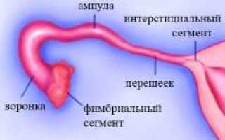 Перекрут яичника и маточной трубы: причины, симптомы, диагностика, лечение и профилактика заболеваний
