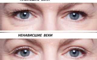 6 упражнений при нависшем веке для улучшения внешнего вида
