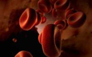 Отравление угарным газом. Первая помощь при отравлении и профилактика.