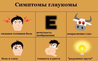 Как распознать и что делать при остром приступе глаукомы: советы и рекомендации