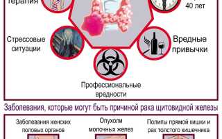Рак щитовидной железы: симптомы, признаки, причины, диагностика и лечение заболевания у пациентов.