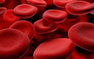 Гемолитическая анемия. Причины, симптомы, диагностика и лечение патологии у пациентов