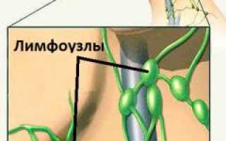 Болят (воспалены) лимфоузлы на шее: причины и возможные решения