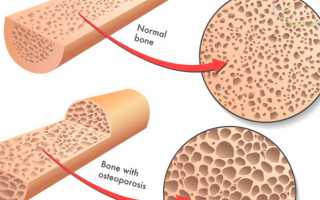 Что произойдет с Вашим телом, если выпивать стакан кефира каждый день? Узнайте полезные эффекты