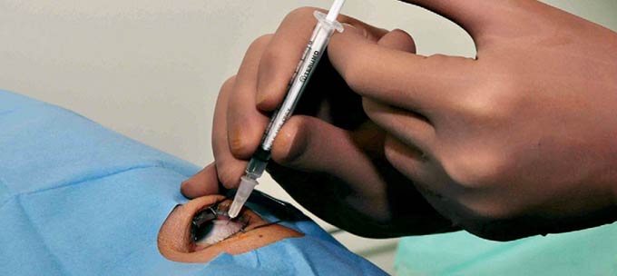 анти-VEGF терапия