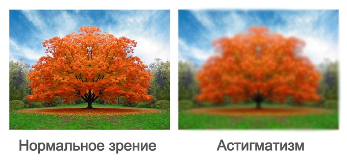нормальное зрение и при астигматизме