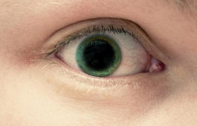 расширенный зрачок