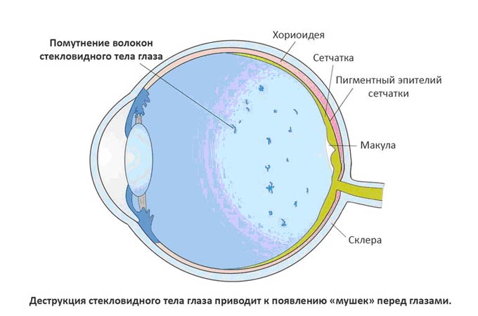 стекловидное тело