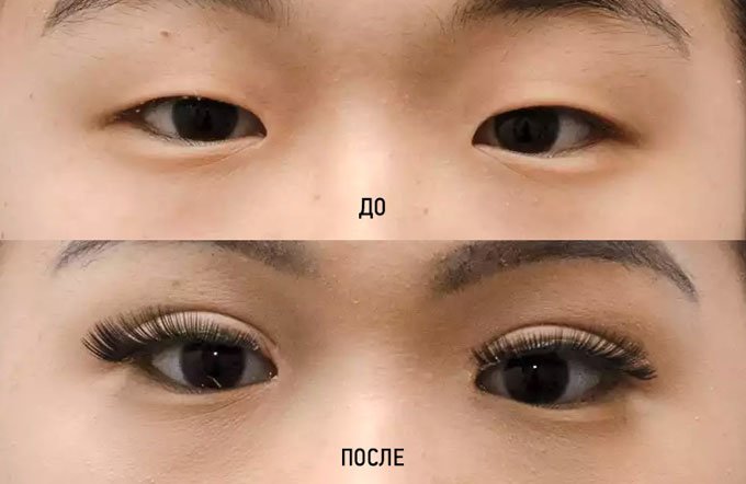 эпикантус у русских