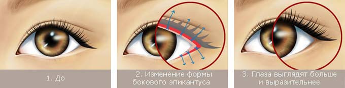 разрез глаз