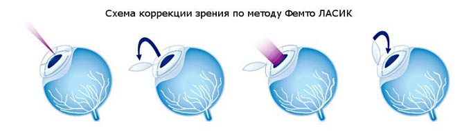 Фемто Ласик