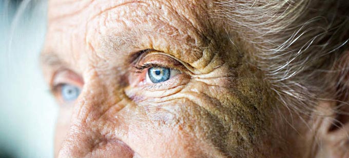 возрастная катаракта