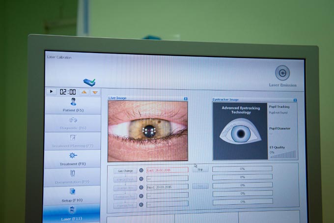 диагностика глаукомы