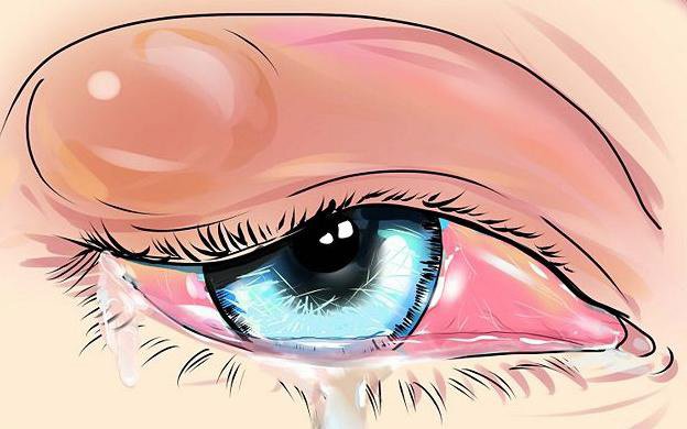 ячмень на верхнем веке