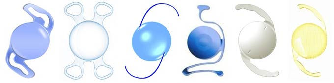 производители интраокулярных линз