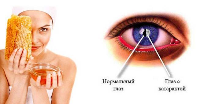 рецепты с медом