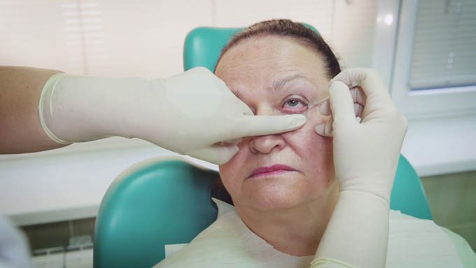 промывание глаз при блефарите