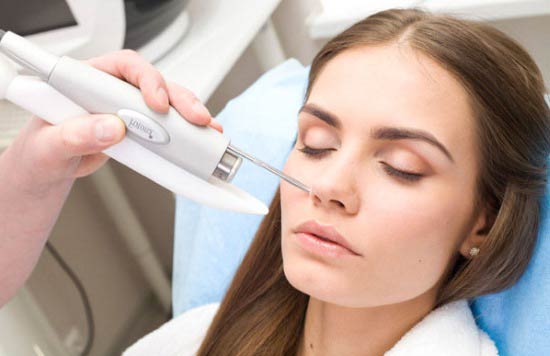 лазерное удаление милиумов