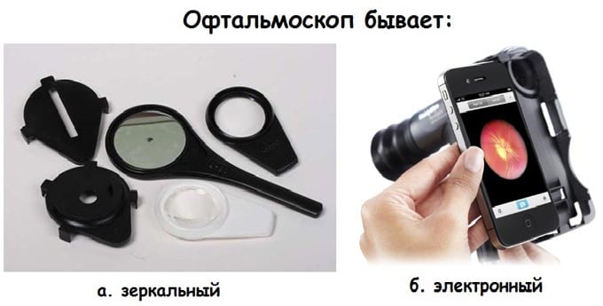 виды офтальмоскопов