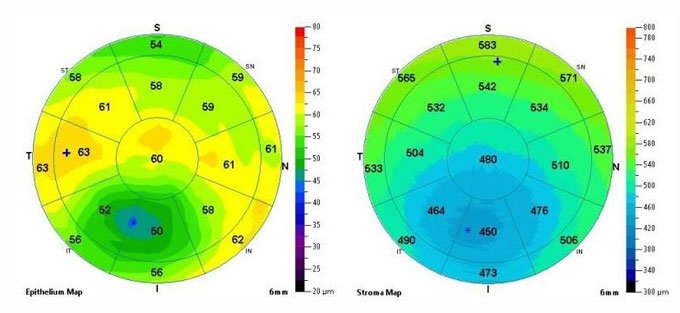 исследование поверхности глазного яблока