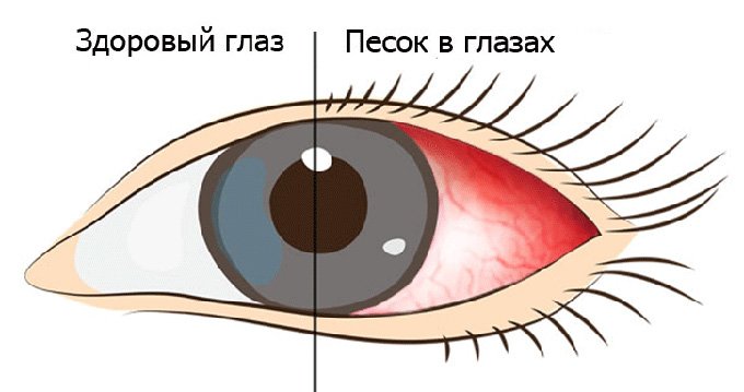 здоровый глаз