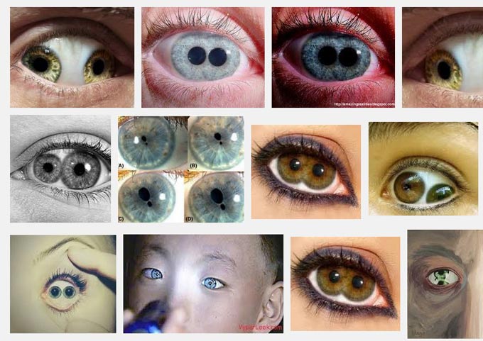 виды поликории