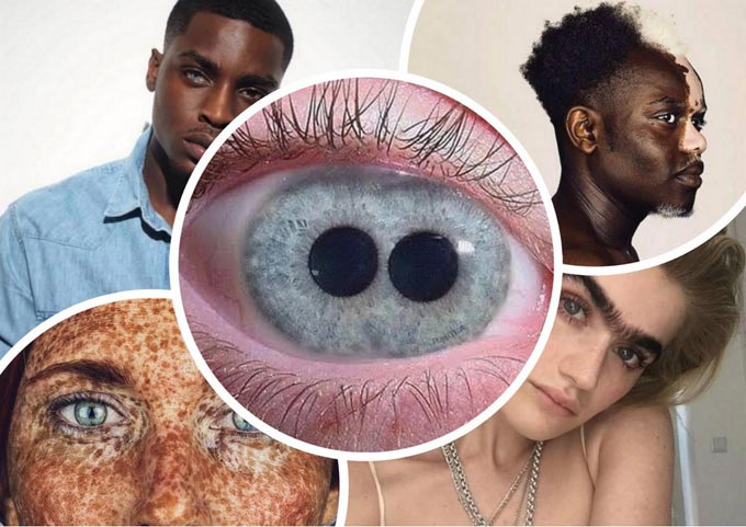 ложная поликория