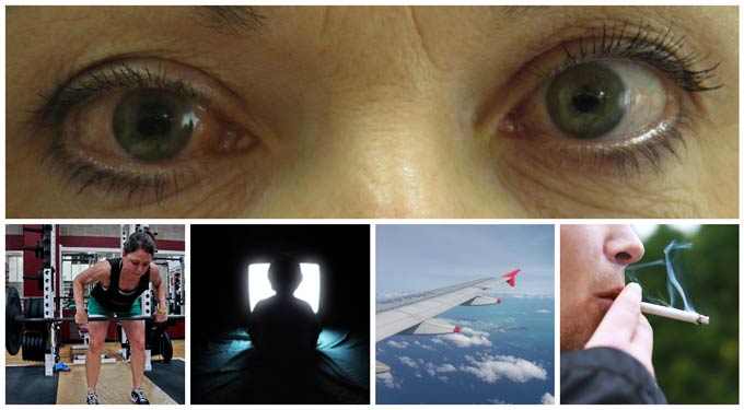 можно ли смотреть телевизор при глаукоме