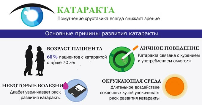 причины развития катаракты