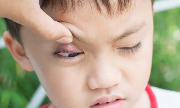 сколько зреет ячмень на глазу