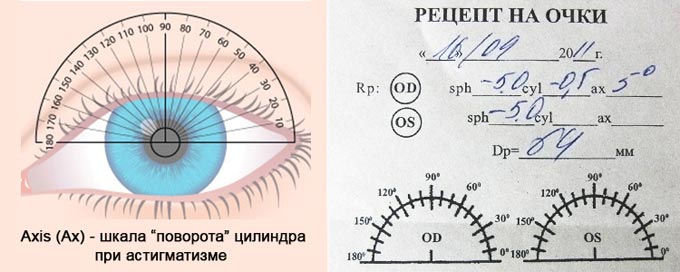 рецепт на очки при сложном астигматизме