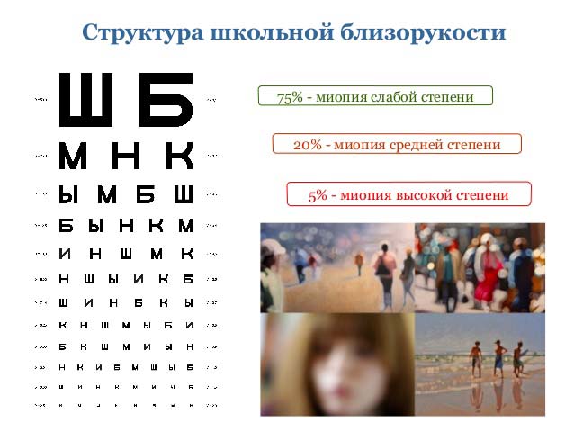 миопия 3 степени
