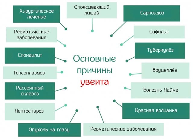 причины увеита