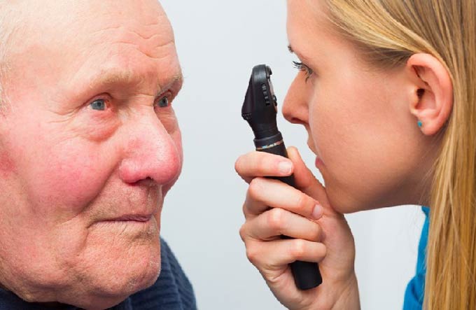 старческая катаракта