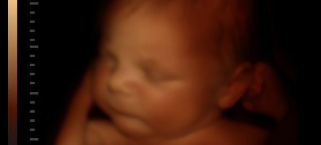 40 недель 40 недель