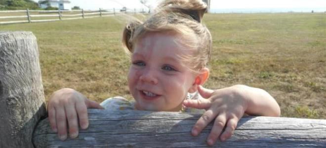 болезнь лея болезнь лея