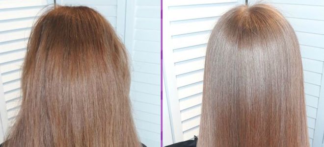 что дает биксипластия что дает биксипластия