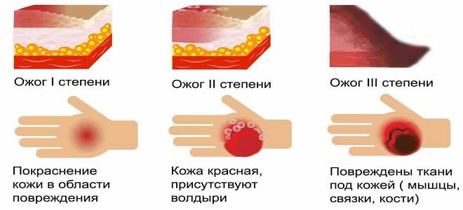 действие пантенола при ожоге действие пантенола при ожоге